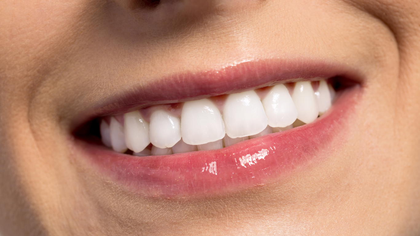 How to Whiten Teeth in An easy stepbystep guide